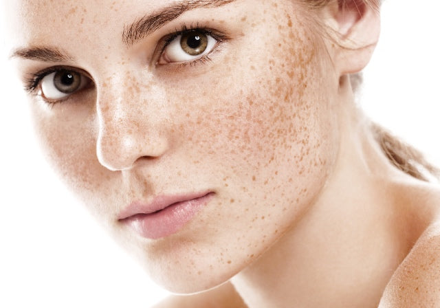 Ma routine contre les Taches Pigmentaires